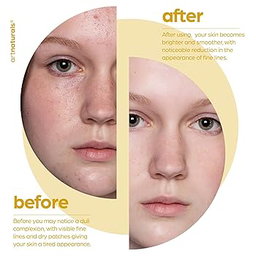 Base Serum Acido Lactico