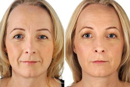 Base en Crema, Borrador de Lineas de Expresion. 