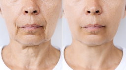 Base en Crema, Borrador de Lineas de Expresion. 