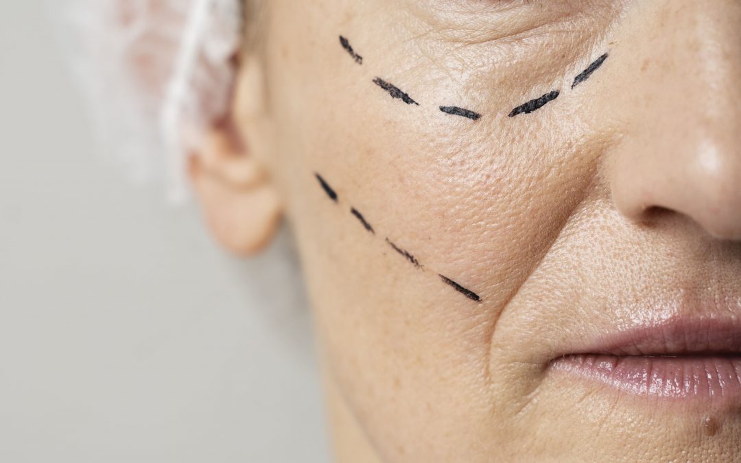 Base en Crema, Borrador de Lineas de Expresion.