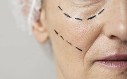 Base en Crema, Borrador de Lineas de Expresion. 