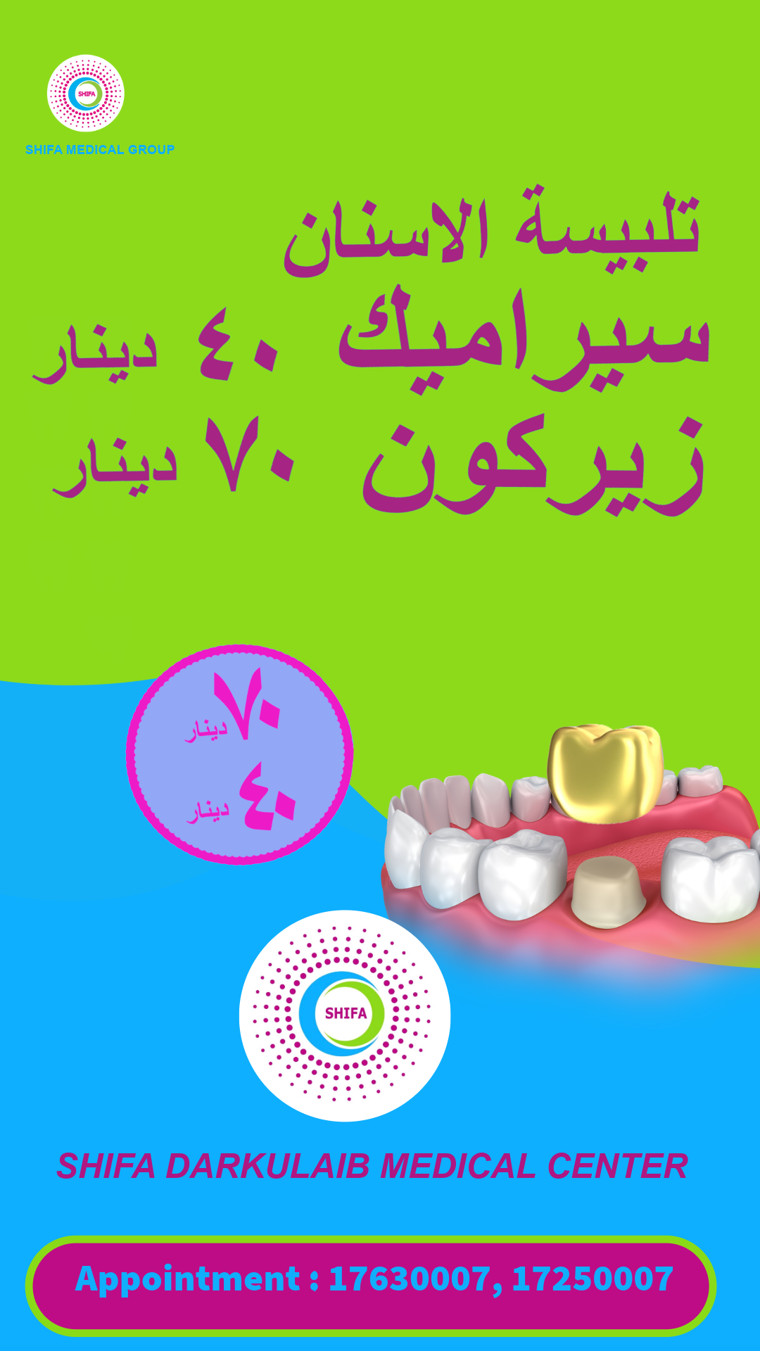 Dental Crowns – Ceramic & Zircon_2