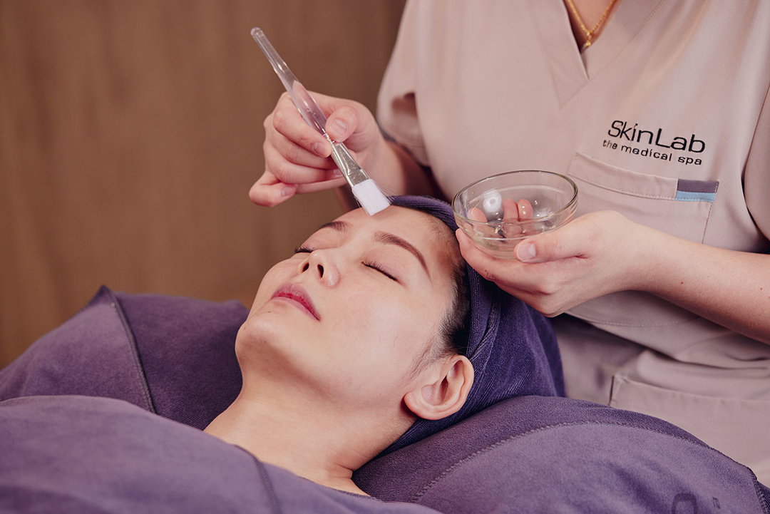 SkinLab’s Melasma Peel Facial