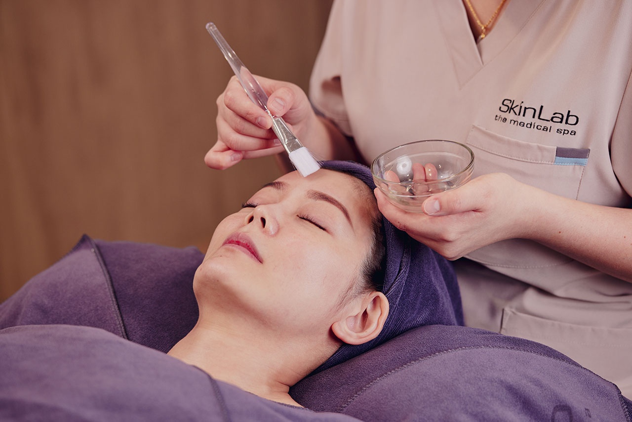 SkinLab’s Melasma Peel Facial_0