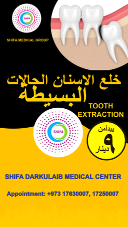 Simple Tooth Extraction
