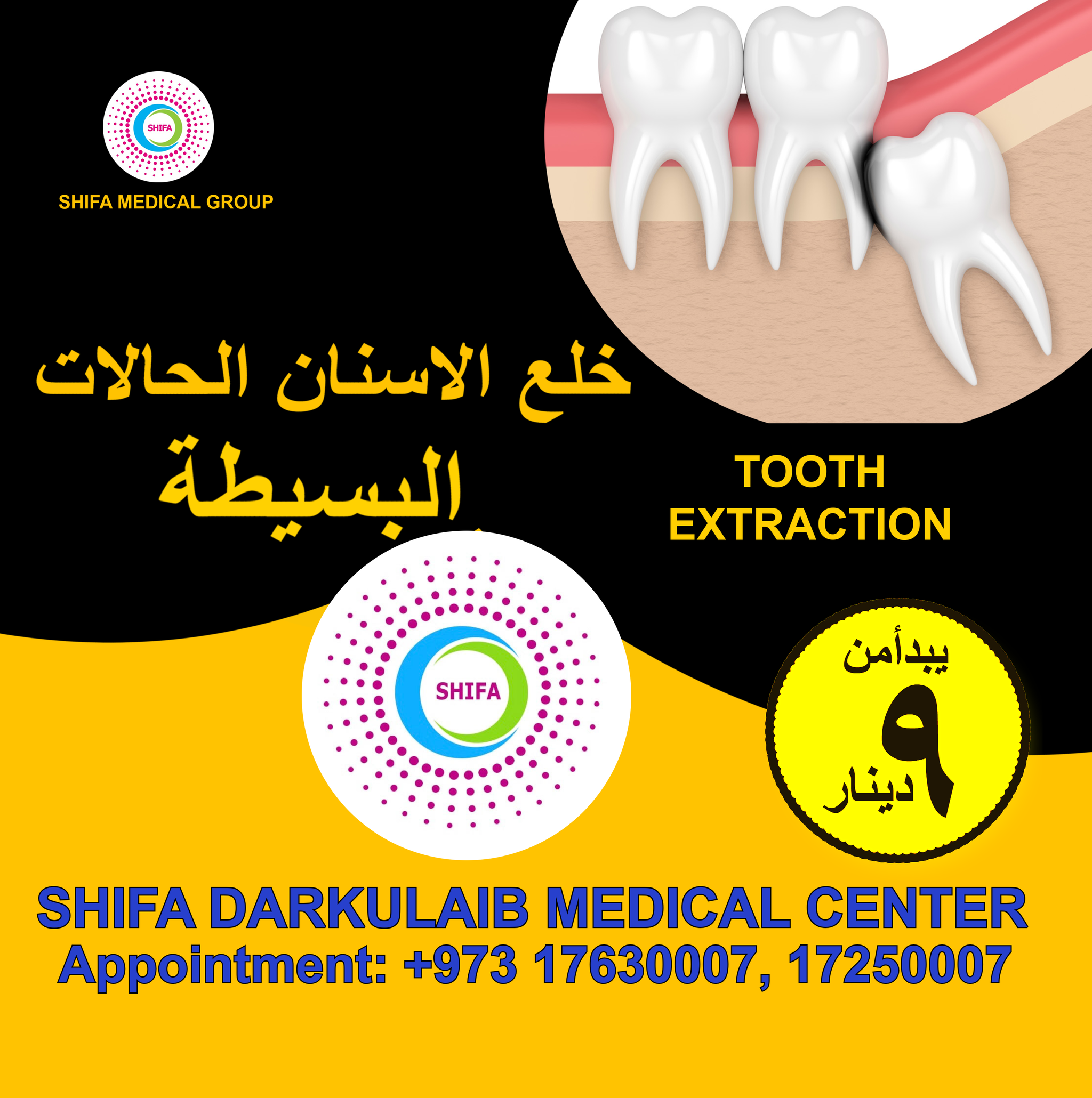 Simple Tooth Extraction_1