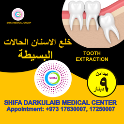 Simple Tooth Extraction