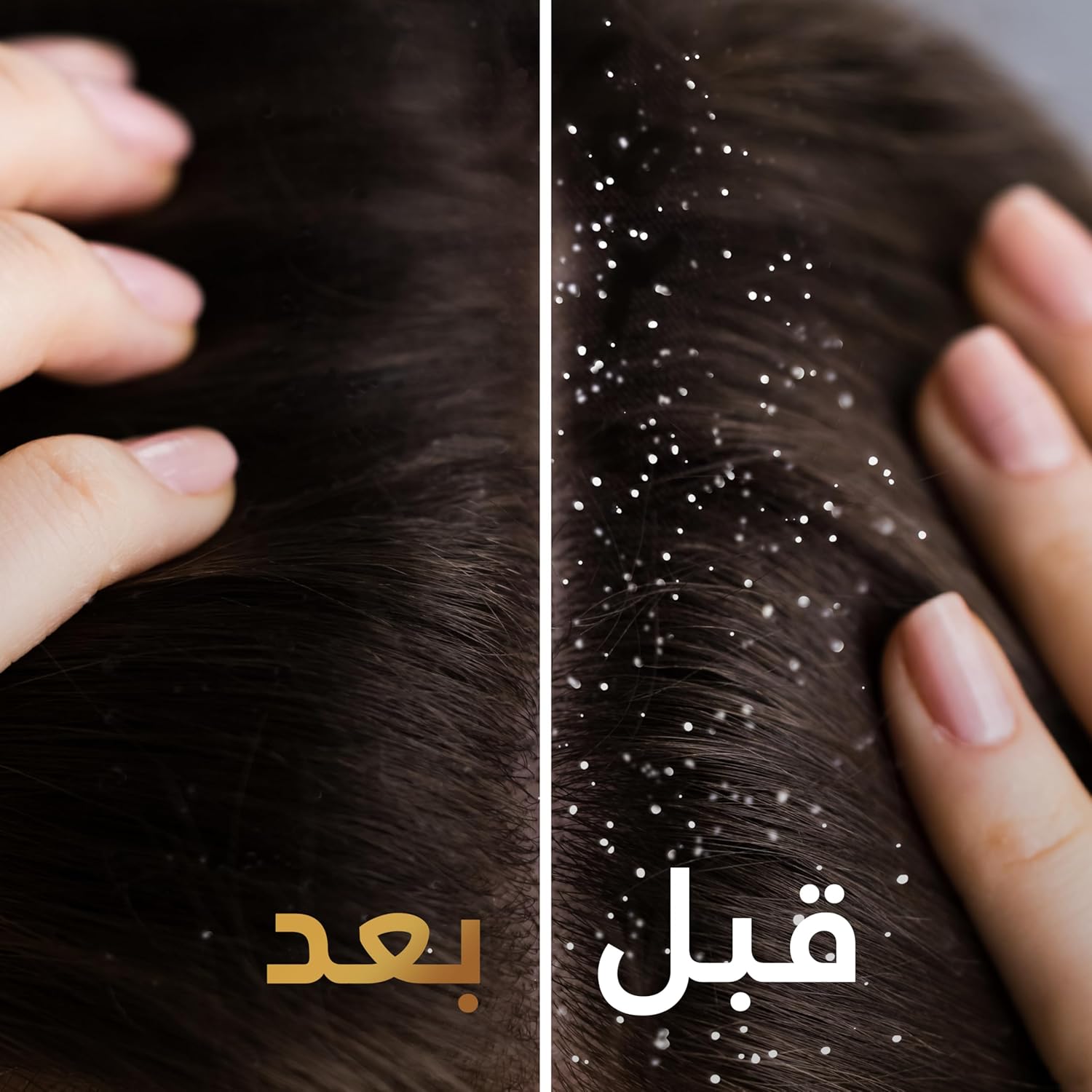 Pantene Pro-V 2in1 Anti-Dandruff Shampoo + Conditioner_1