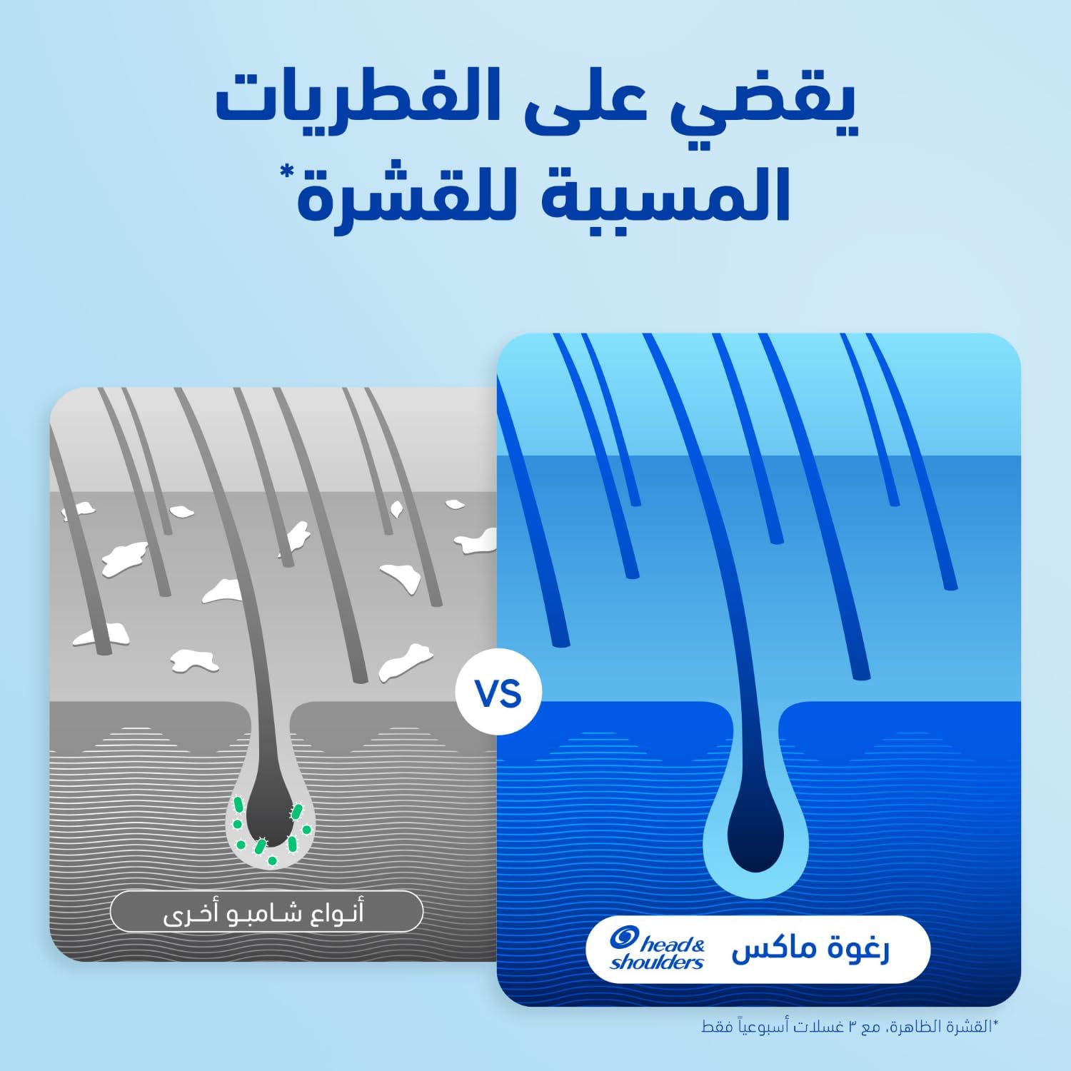 Head & Shoulders citrus fresh anti dandruff shampoo, oil control of greasy hair_5