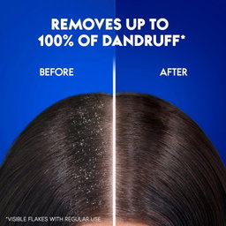 Head & Shoulders Dry Scalp Care Anti-Dandruff Shampoo With Almond Oil