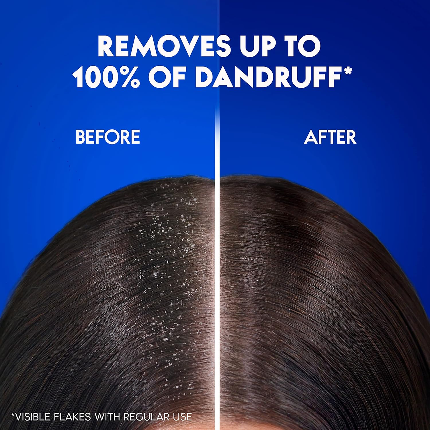 Head & Shoulders Total Care Anti-Dandruff Shampoo 390ml_2