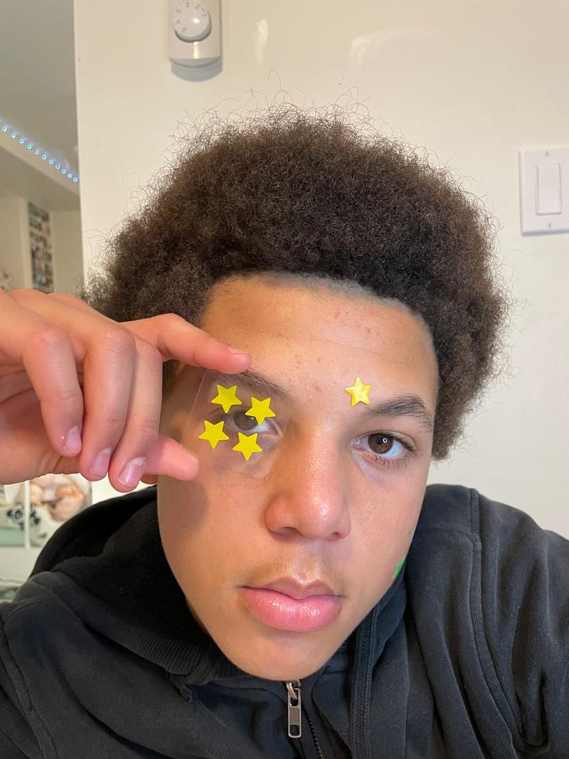 Pimples Patches _1