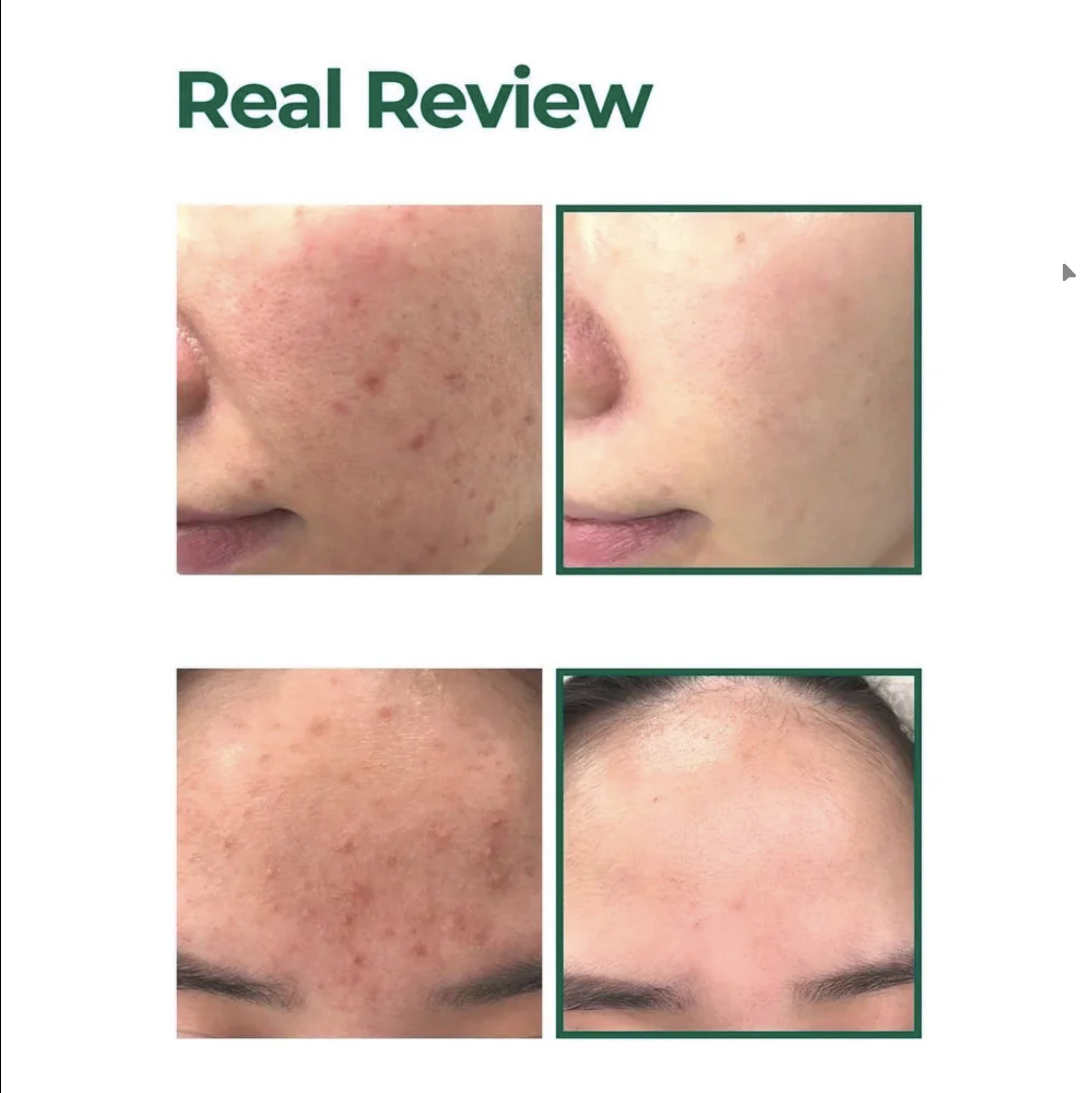 SOMEBYMI AHA.BHA.PHA 30 Days Miracle Serum 50ml_1