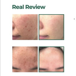 SOMEBYMI AHA.BHA.PHA 30 Days Miracle Serum 50ml