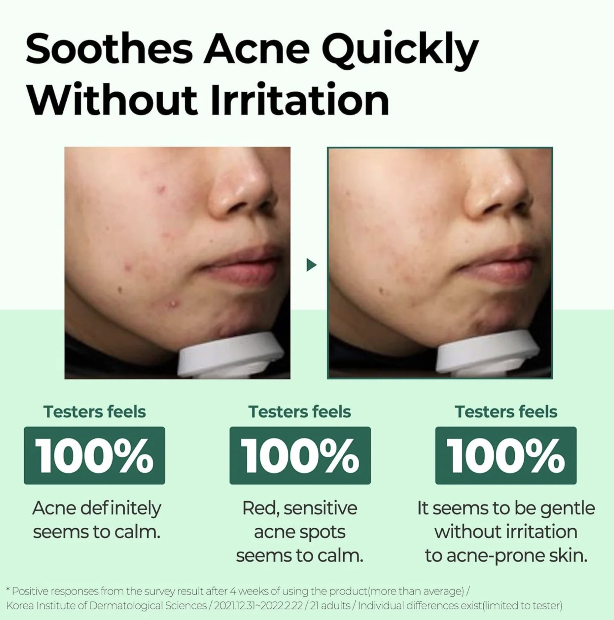 SOMEBYMI AHA.BHA.PHA 30 Days Miracle Starter Kit_2