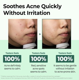 SOMEBYMI AHA.BHA.PHA 30 Days Miracle Starter Kit