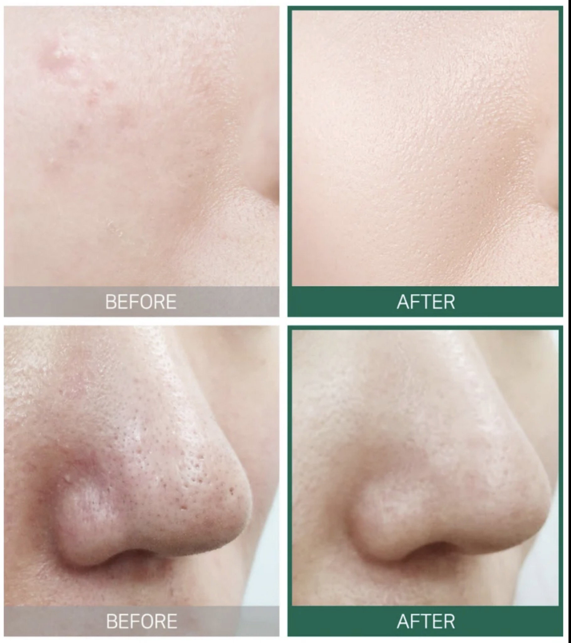 SOMEBYMI AHA.BHA.PHA 30 Days Miracle Starter Kit_3