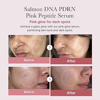Medicube PDRN Pink Peptide Serum - 30ml_2