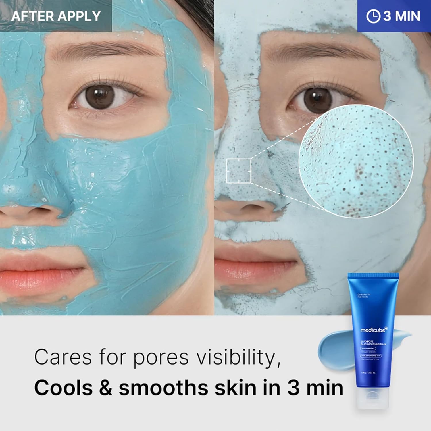 Medicube Zero Pore Blackhead Mud Mask - 100 grams_2