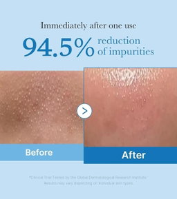 Medicube Zero Pore Blackhead Deep Cleansing Oil - 205ml