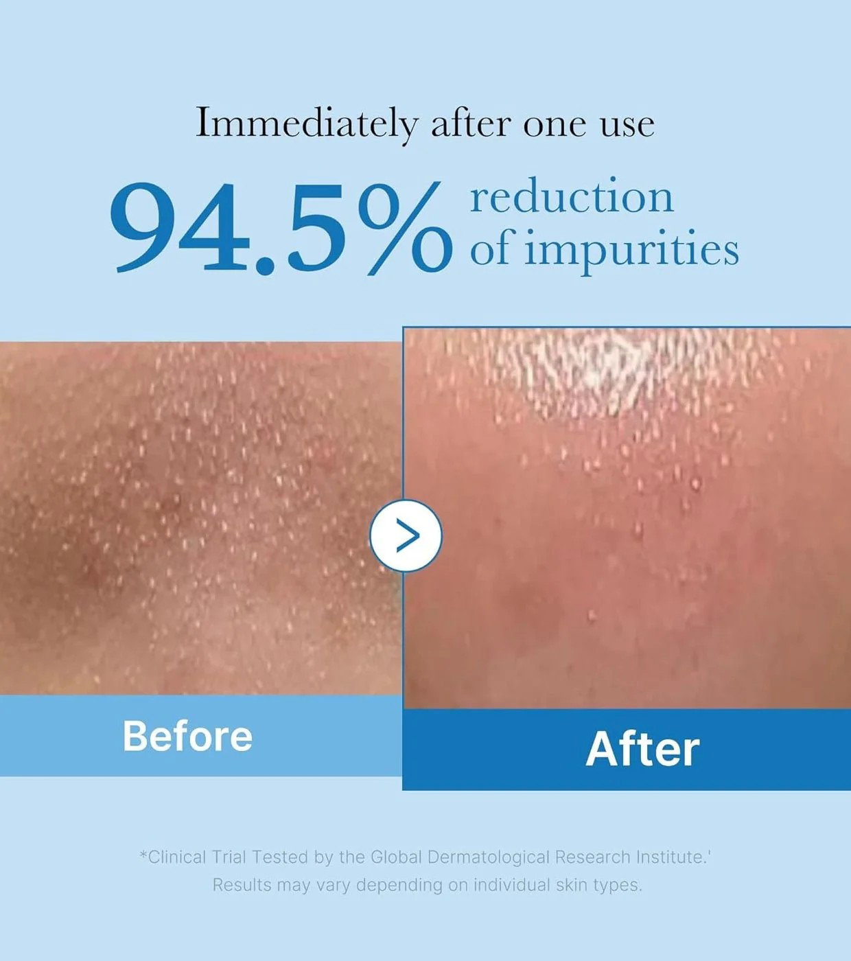 Medicube Zero Pore Blackhead Deep Cleansing Oil - 205ml_1