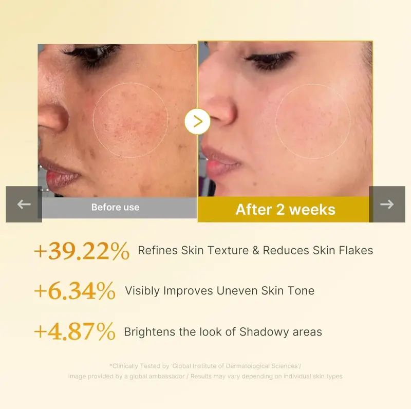 Medicube kojic acid toner  تونر تفتيح وتجديد البشرة بحمض الكوجيك والكركم من ميديكيوب_2