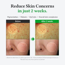 Dr.Althea Gentle Vitamin C Serum 20%