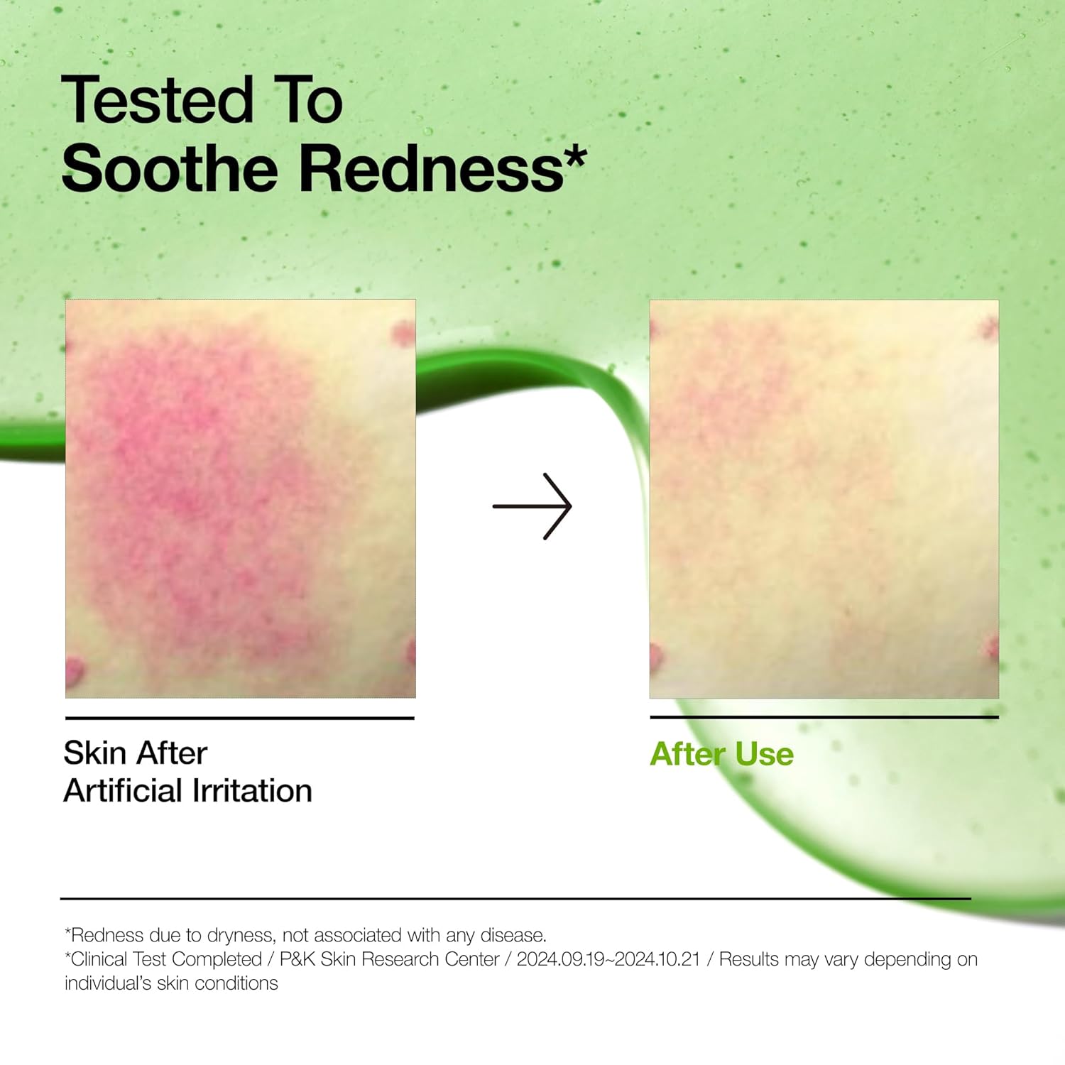 Anua Azelaic Acid 10 Hyaluron Redness Soothing Serum_2