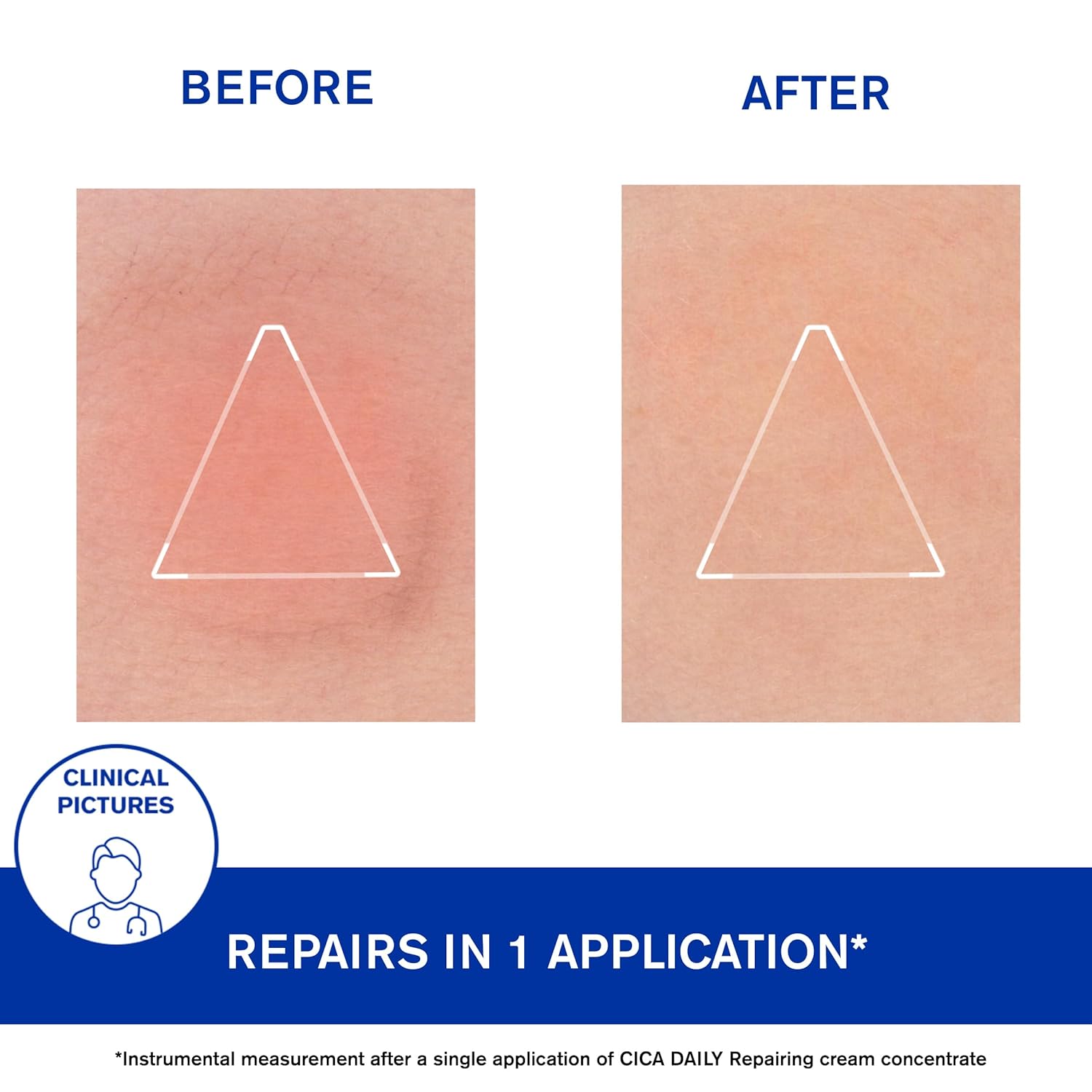 URIAGE Cica-Daily Repairing Gel-Cream for Face_4