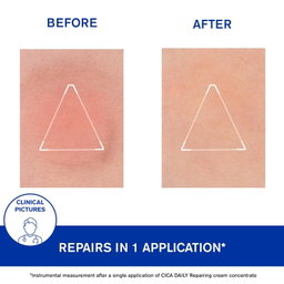 URIAGE Cica-Daily Repairing Gel-Cream for Face