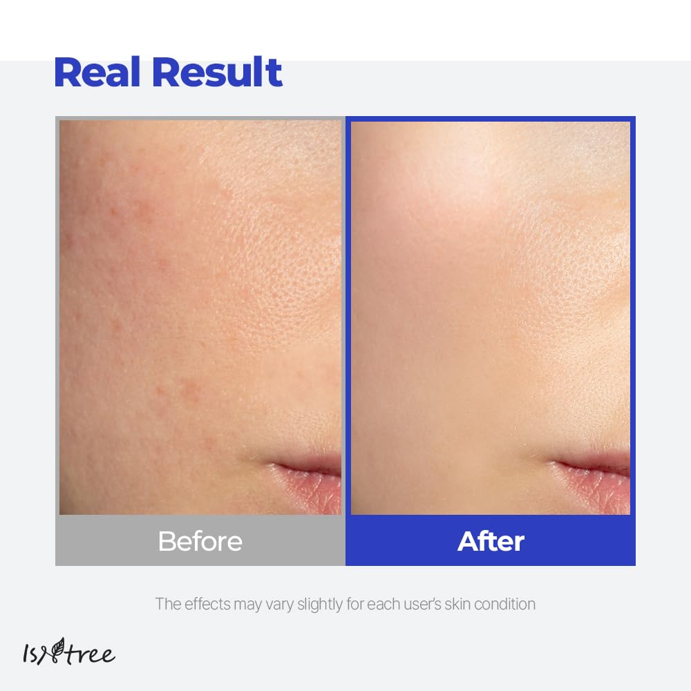 Isntree Hyaluronic Acid Aqua Gel Cream_3