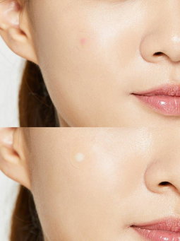 Cosrx Acne Pimple Patch Absorbing Hydrocolloid