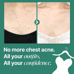 SOME BY MI AHA BHA PHA 30 Days Miracle Acne Clear Body Cleanser