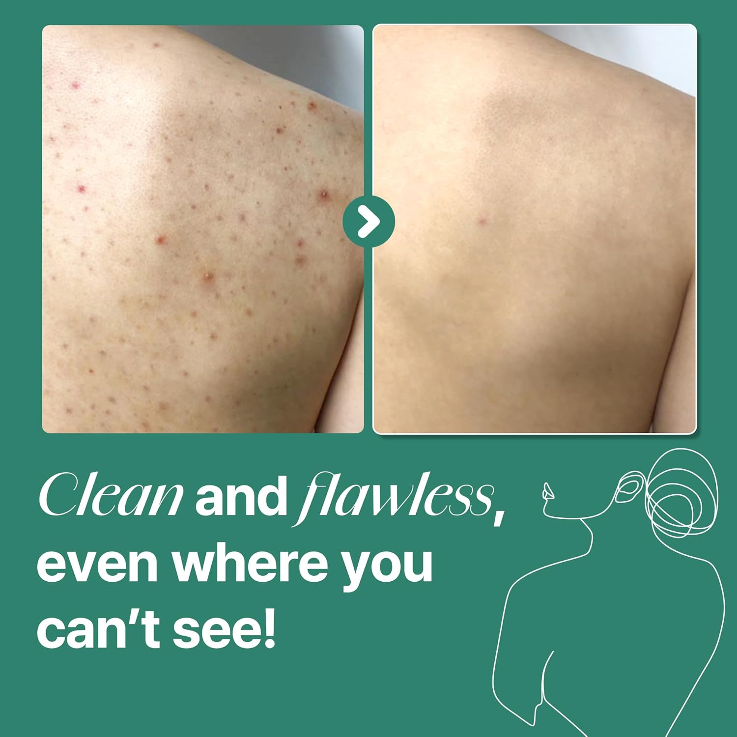 SOME BY MI AHA BHA PHA 30 Days Miracle Acne Clear Body Cleanser_4