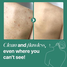 SOME BY MI AHA BHA PHA 30 Days Miracle Acne Clear Body Cleanser