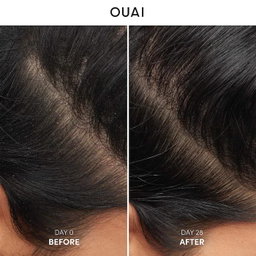 OUAI - Anti Dandruff Shampoo