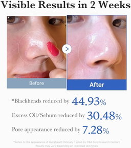 Medicube Zero Pore Pads 2.0