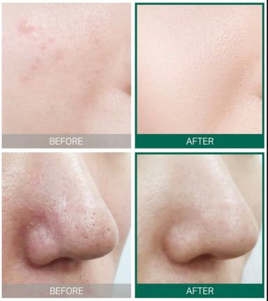 SOMEBYMI AHA.BHA.PHA 30 Days Miracle Starter Kit_3