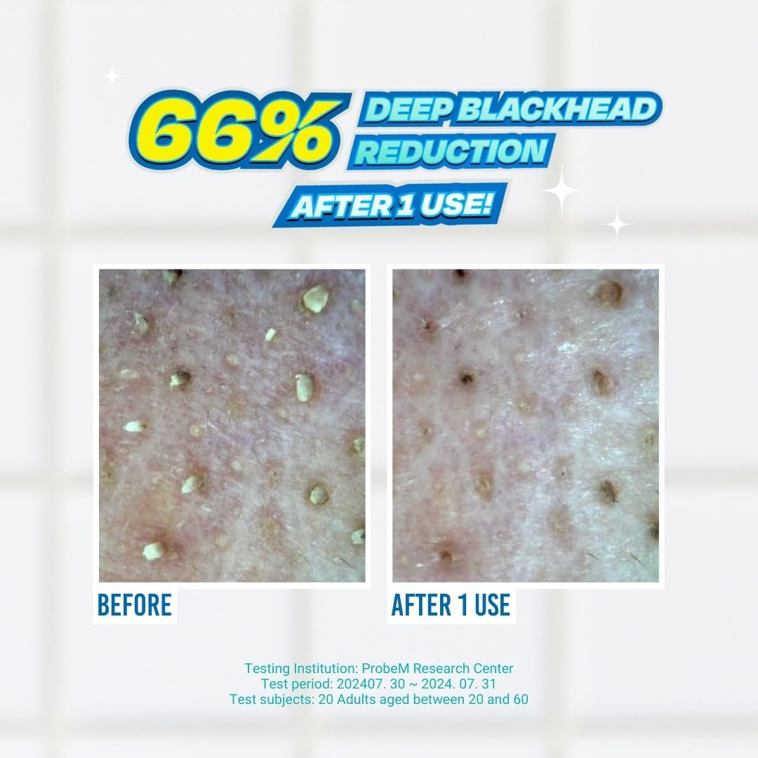 Jumiso Blackhead Melting Softener_2