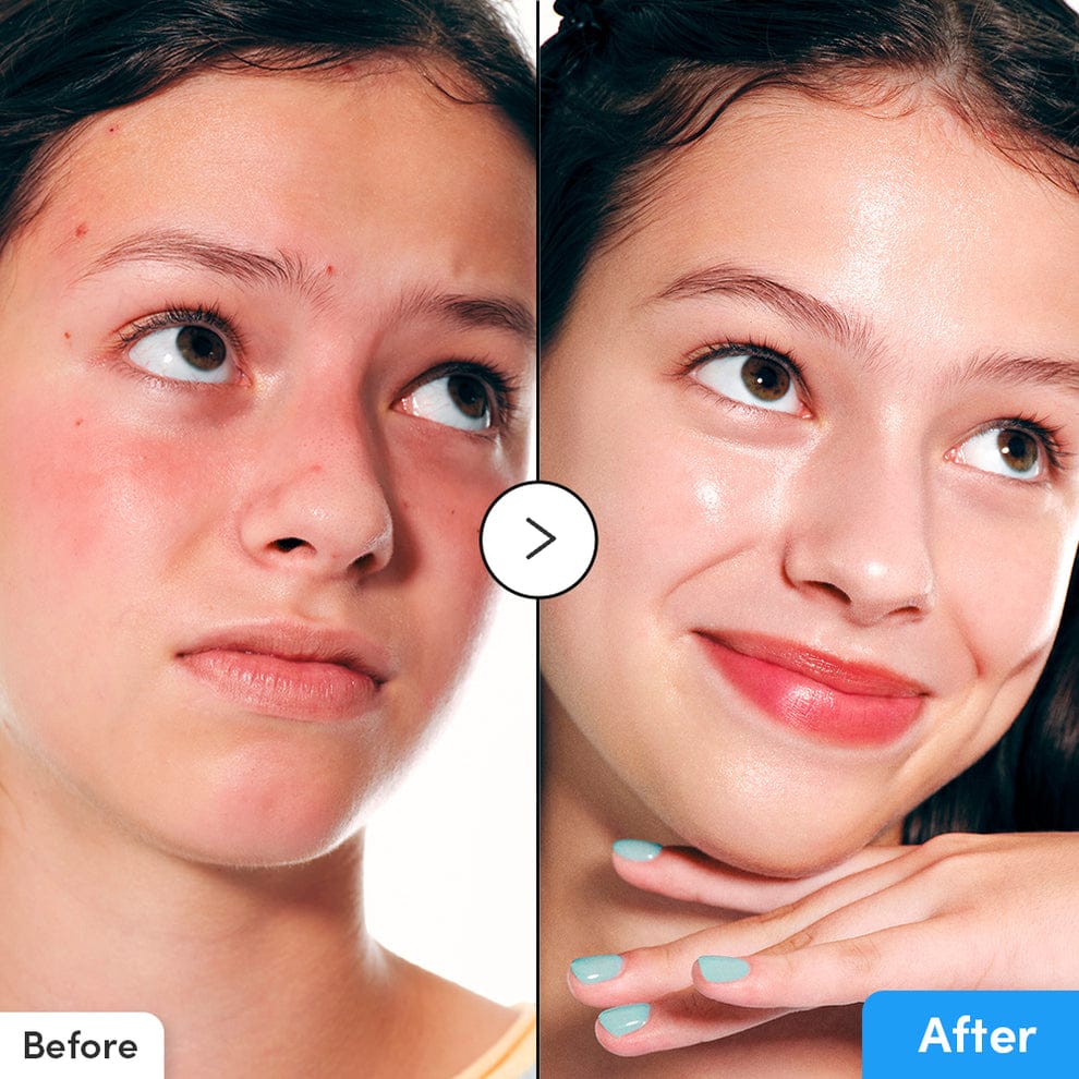 Eqqualberry - Hyaltoin Flooding Serum_4
