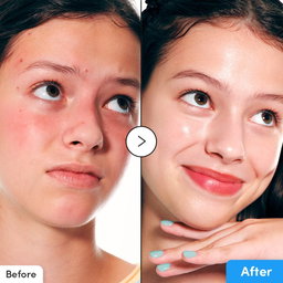 Eqqualberry - Hyaltoin Flooding Serum