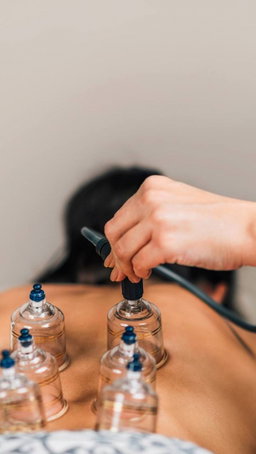 Cupping