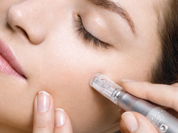 Dermapen / Microneedeling