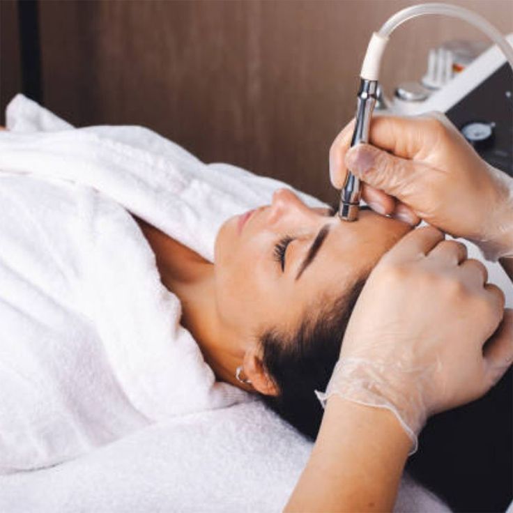 Microdermabrasion_0