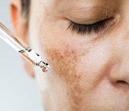 Sun Damage Renewal