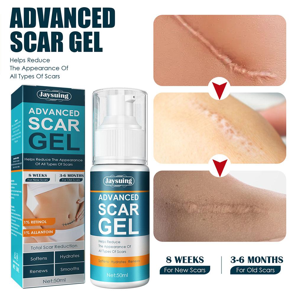SCAR GEL _3