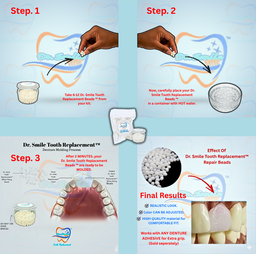 Dr. Smile Tooth Replacement Kit™