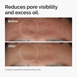 Niacinamide 10% + Zinc 1% Serum – 30ml