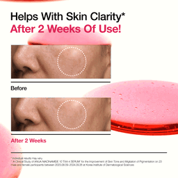 Anua Niacinamide 10 TXA 4 Serum for Brightening and Dark Spots
