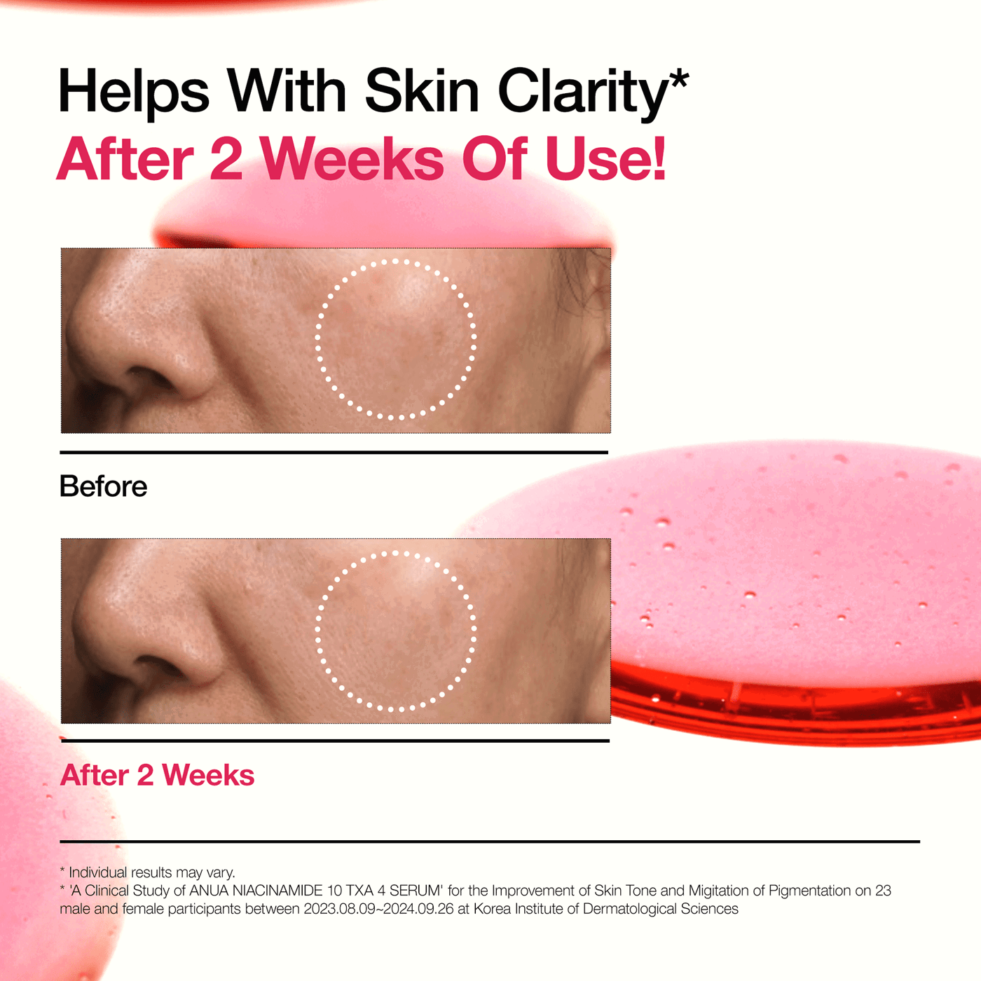 Anua Niacinamide 10 TXA 4 Serum for Brightening and Dark Spots_3